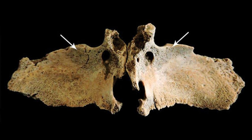 Marcas de estrés en huesos