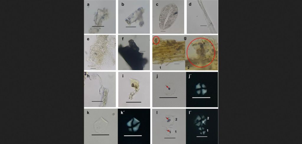 Muestras de cálculo dental de El Olivar