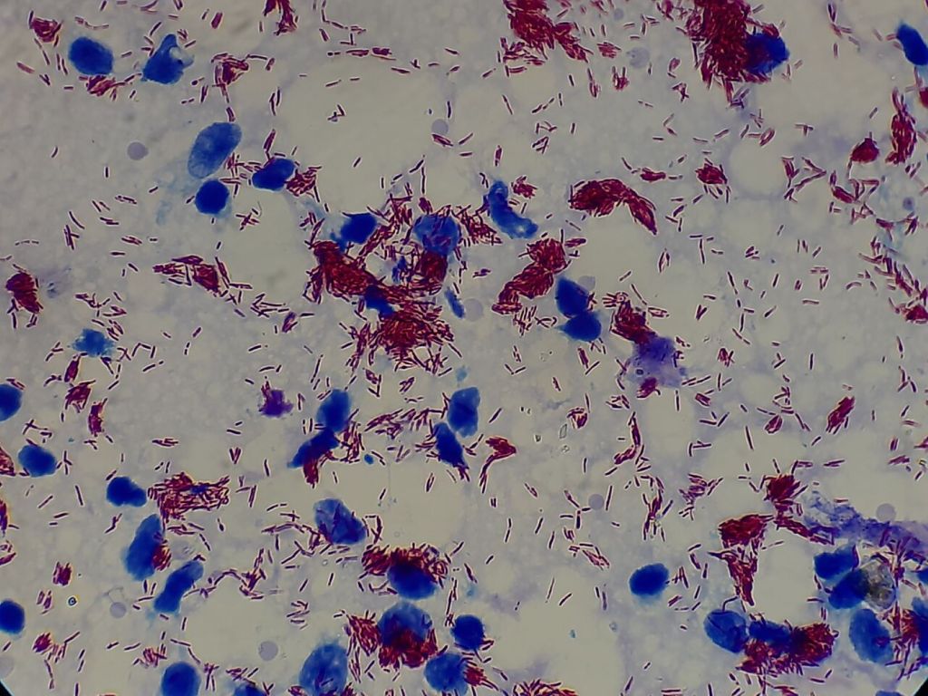 Mycobacterium leprae