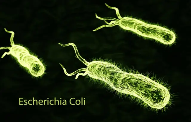 3 bacterías de E. coli