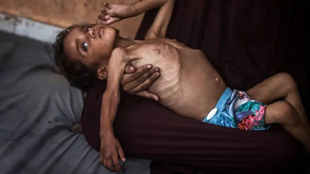 Yezen, un niño de dos años, en el regazo de su madre