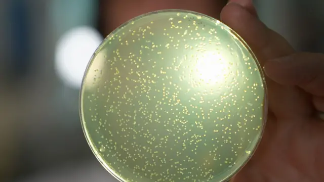 Una placa de Petri iluminada con una luz brillante con manchas blancas de levadura.