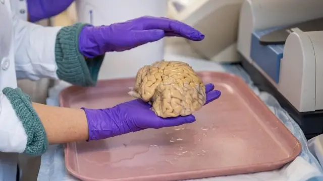 Una científica con bata de laboratorios y guantes de látex morados sostiene un cerebro sobre una bandeja rosada