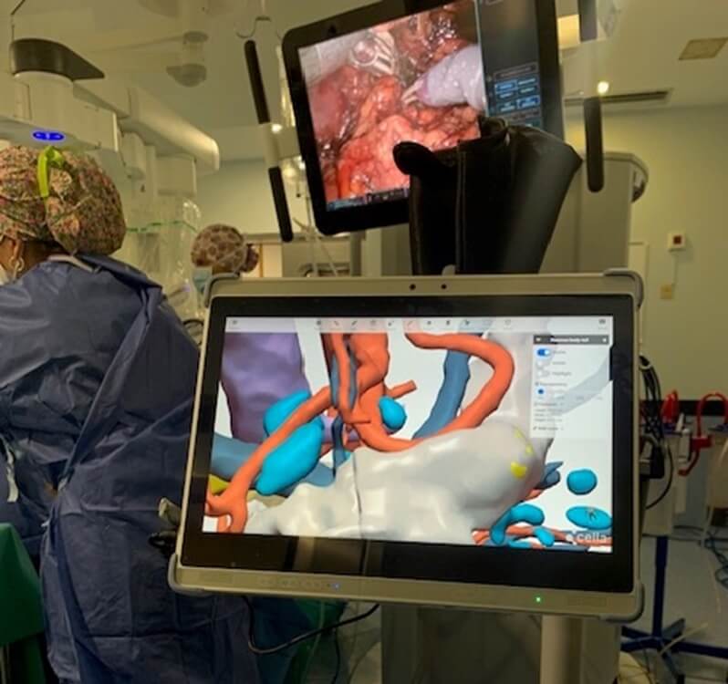 Utilización de modelos 3D para guiado quirúrgico durante la cirugía. Fuente: imágenes con autorización de uso por Cella Medical Solutions