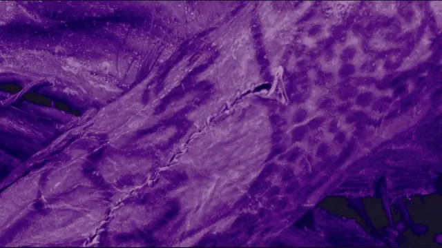 Una imagen de un escáner del cuerpo de la momia de hielo. Tiene un tono púrpura y muestra el brazo de la mujer. En la piel hay un patrón de tinta que muestra líneas y puntos. También se aprecia una marca de corte en la piel provocada durante el enterramiento.