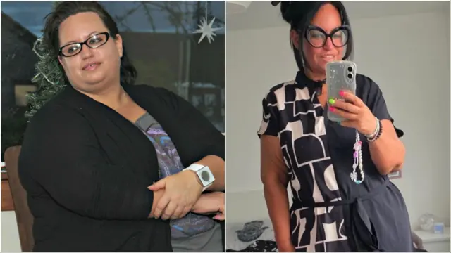 Dos fotos de la misma mujer con pelo negro recogido y anteojos de marco negro. En la foto de la izquierda está sentada con las manos cruzadas y viste una chaqueta tejida negra. En  la foto de la derecha está parada, luce mucho más delgada y tiene un vestido blanco y negro con mangas cortas, mientras se toma un 