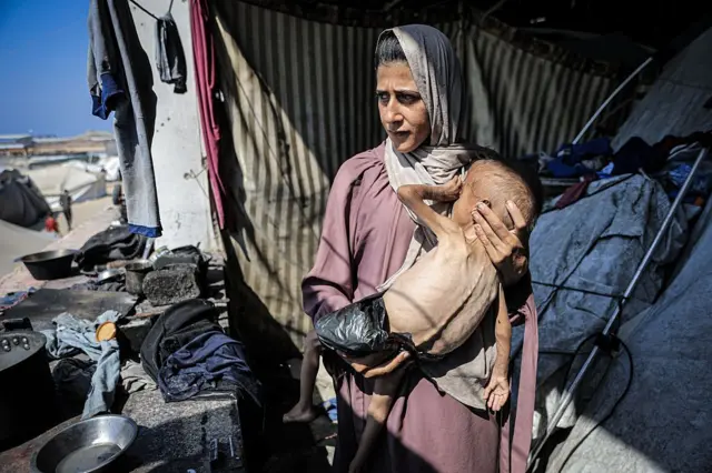 Una madre en Gaza con su hijo desnutrido.