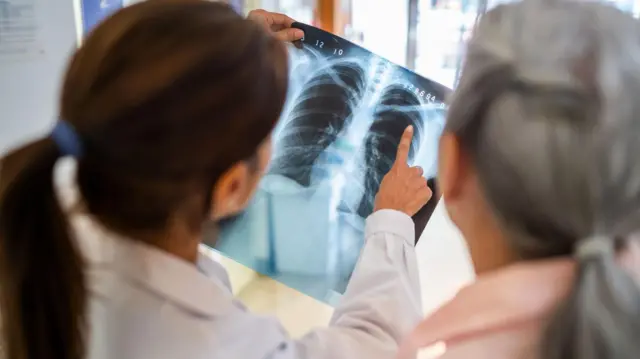 Una médica analiza una radiografía de pulmones.