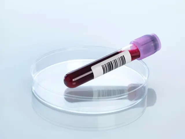 Un tubo con sangre en su interior dentro de una placa de petri.