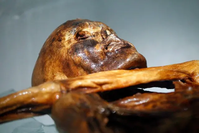 Ötzi