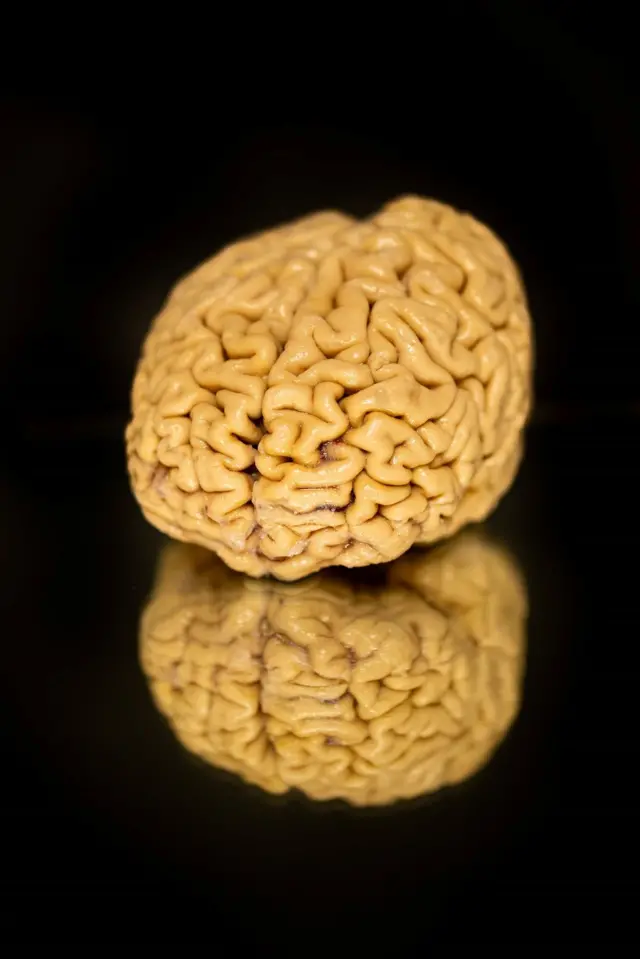 Un cerebro en un fondo negro