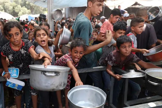 Niños desnutridos en Gaza