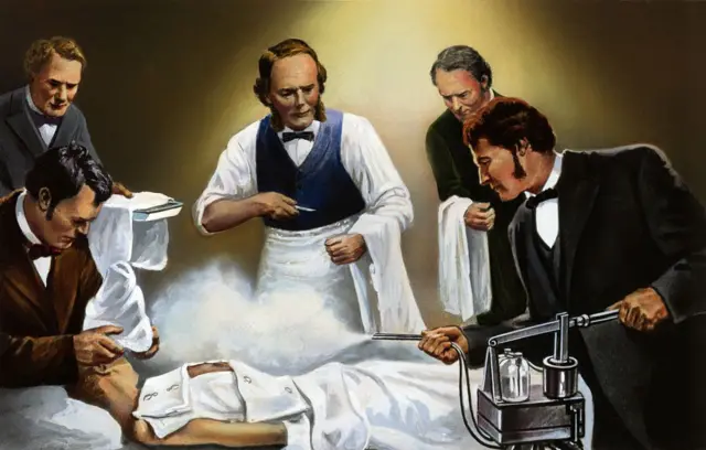 Joseph Lister dirigiendo el uso de ácido carbólico en aerosol en una de sus primeras intervenciones quirúrgicas antisépticas, circa 1865.