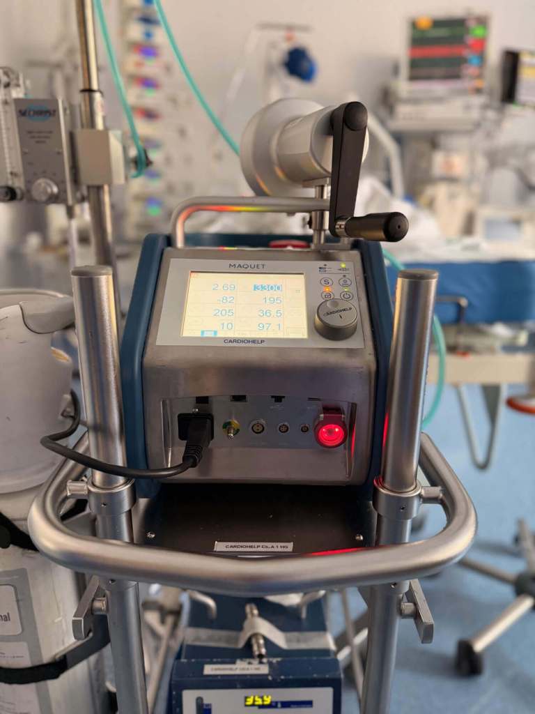 Cuando el corazón se detiene, la tecnología sigue latiendo- cómo la terapia ECMO mantiene viva la esperanza 1