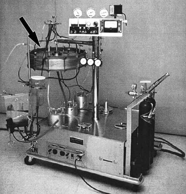Cuando el corazón se detiene, la tecnología sigue latiendo- cómo la terapia ECMO mantiene viva la esperanza 3