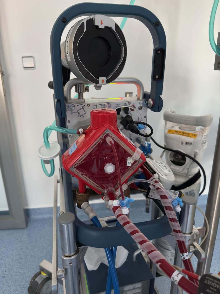 ecmo