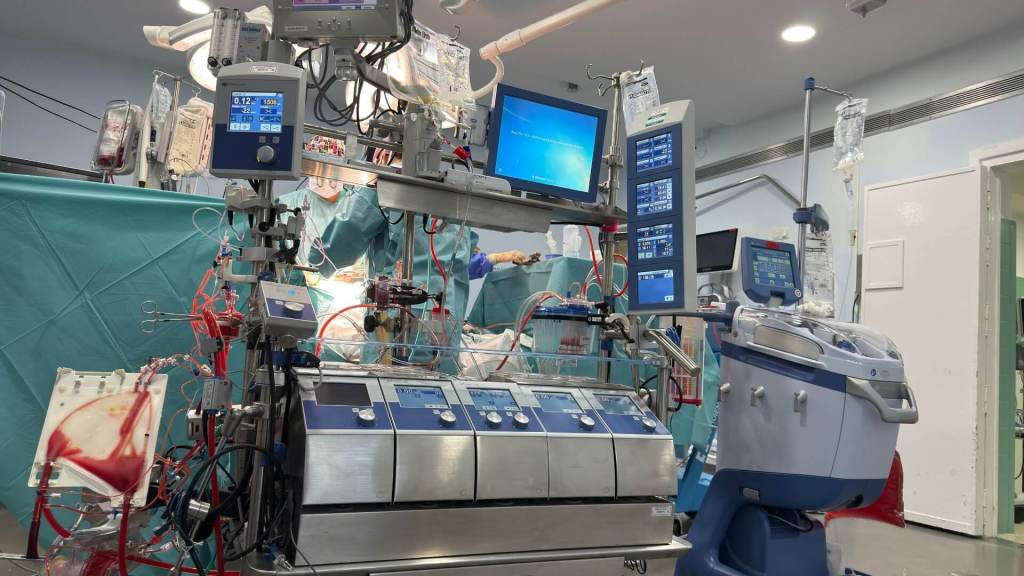 Cuando el corazón se detiene, la tecnología sigue latiendo- cómo la terapia ECMO mantiene viva la esperanza