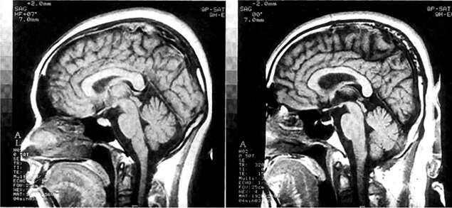 ¿Puede la física cuántica explicar la consciencia? Un repaso crítico a sus principales hipótesis