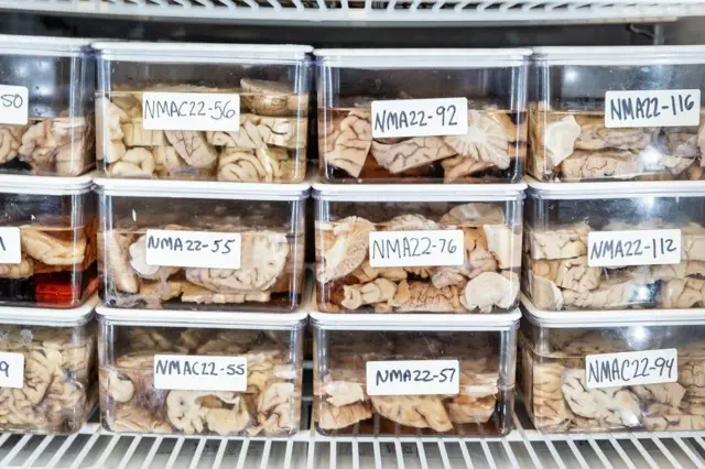 Envases de vidrio con partes de cerebros disecados. Caja envase tiene una etiqueta con letras y números
