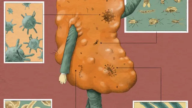 Dibujo que representa al cerumen