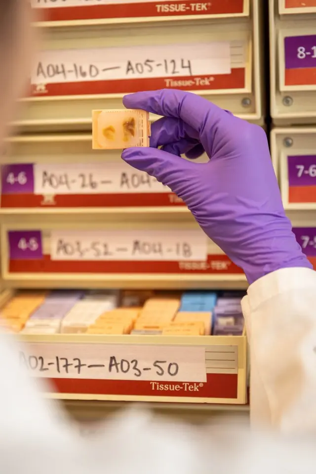 Un investigador con un guante de látex morado sostiene una muestra de un cerebro fijada en un bloque de cera