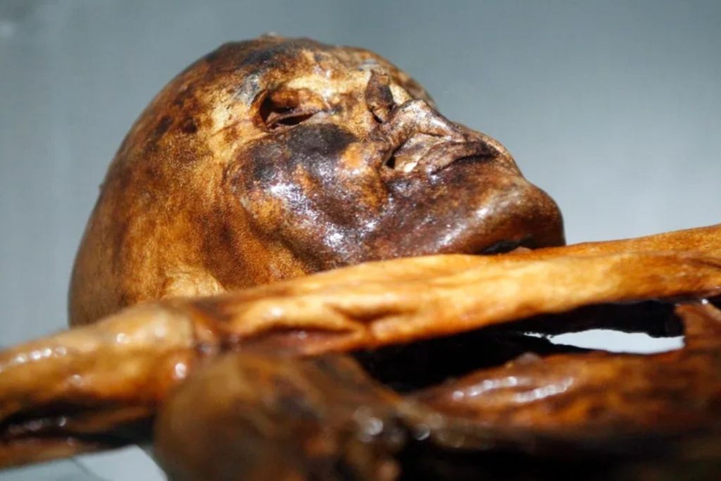 La momia de Ötzi, el Hombre de Hielo, conservada en el Museo Arqueológico de Bolzano (Italia), contiene restos de una cepa del virus del papiloma humano asociada al desarrollo de cáncer