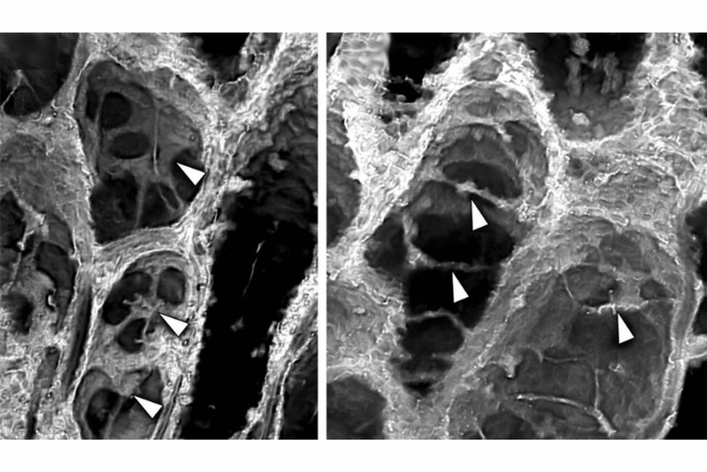 Un análisis detallado de Horneophyton