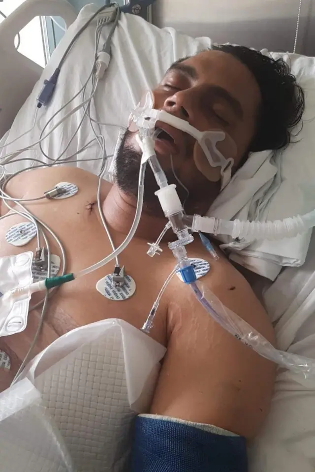 Joao Maldonado en un hospital de Costa Rica después del primer atentado en 2021.