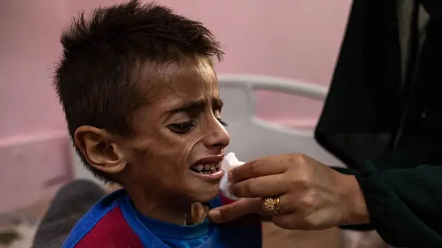 La madre de Osama, de 5 años, intenta alimentarlo en el hospital Nasser