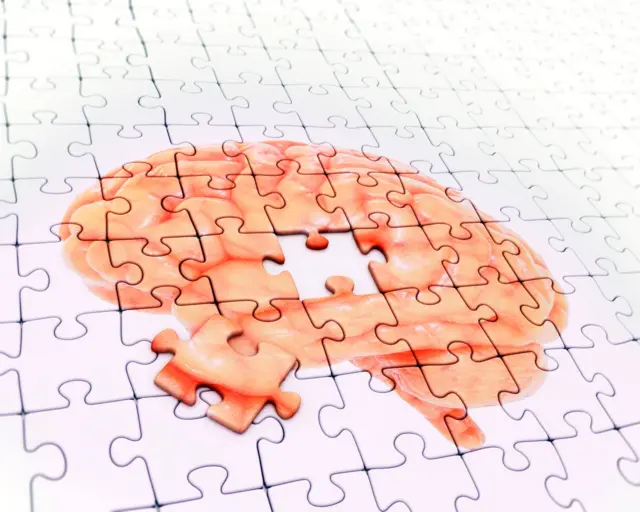 Un rompecabezas del cerebro al que le falta una pieza