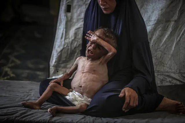 Una madre palestina junto a su hijo desnutrido en Gaza.