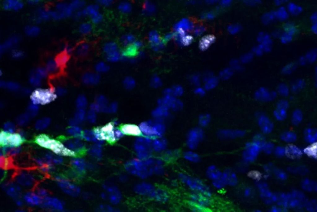 Una imagen microscópica de alta resolución revela astrocitos proliferativos en la sustancia blanca del cerebro de un ratón, resaltados en verde y blanco