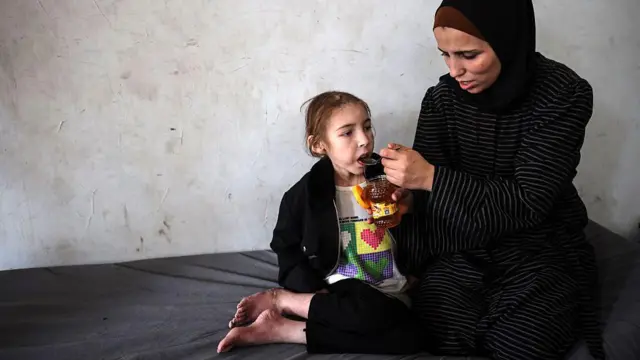 Shuruq trata de consolar a su hija Rafah, de 12 años, que como tantos otros niños sufre de desnutrición.