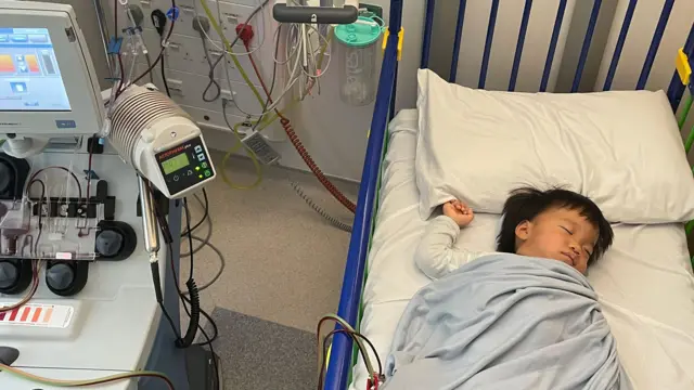 Oliver Chu duerme en una camilla de hospital con tubos conectados a una máquina junto a la camilla.