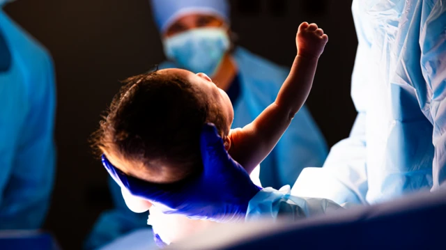 Un bebé recién nacido es cargado por un médico que tiene un guante azul. De fondo, una médica, con mascarilla, bata y gorros azules, ve al bebé