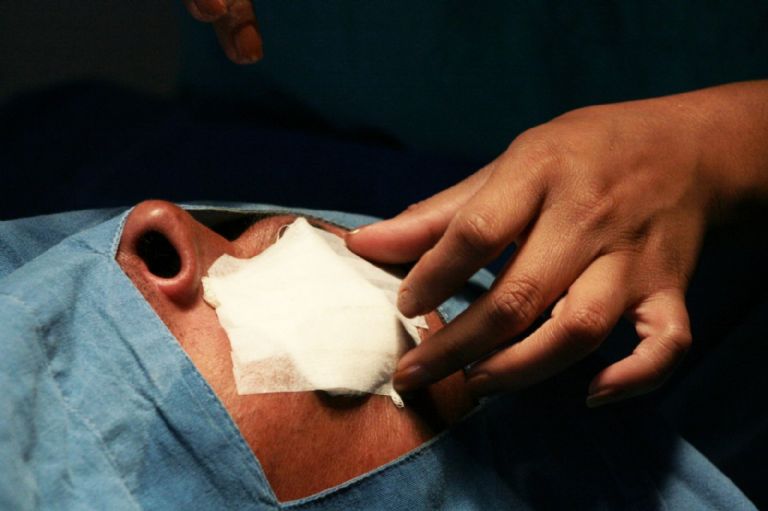 ¿Qué debe tener una clínica para estar certificada en cirugías estéticas?