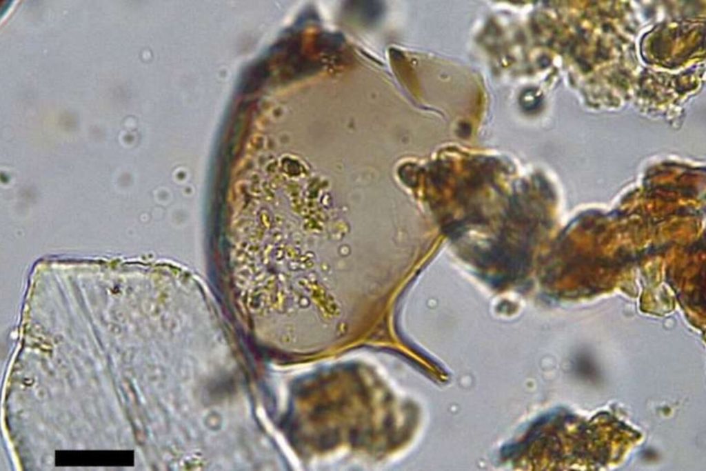 Huevo de Schistosoma mansoni recuperado en una letrina medieval de Brujas