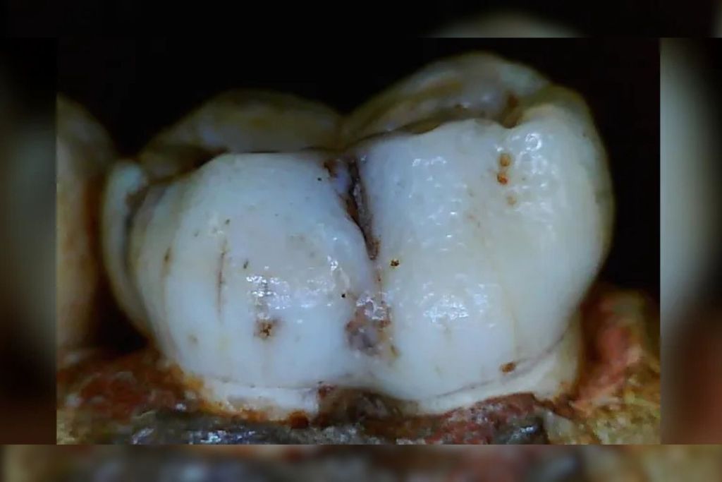 La presencia de agrupaciones de hoyuelos en el esmalte dental de Paranthropus podría deberse a un rasgo genético